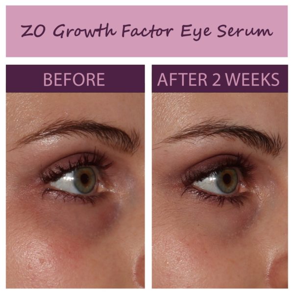 Growth Factor Eye Serum Papillon Medical